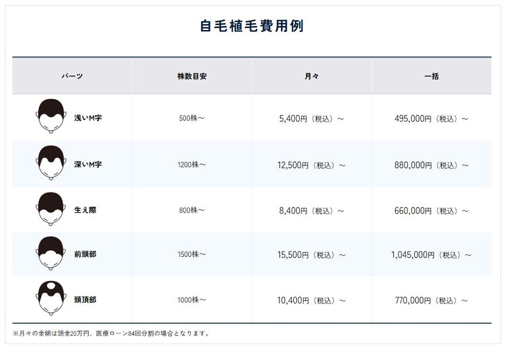 カミノクリニック公式サイトの自毛植毛費用例（前頭部1500株〜1,045,000円など）